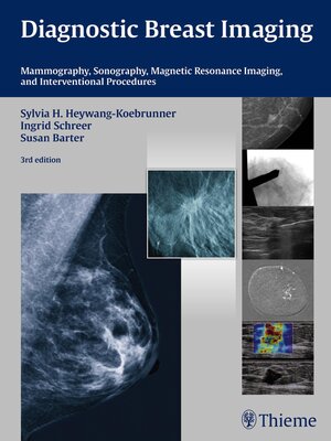 cover image of Diagnostic Breast Imaging